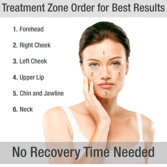 Silk'n Skin Tightening & Lifting Device - Picture 4 of 7